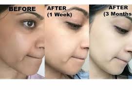Radiant Glow Whitening Cream